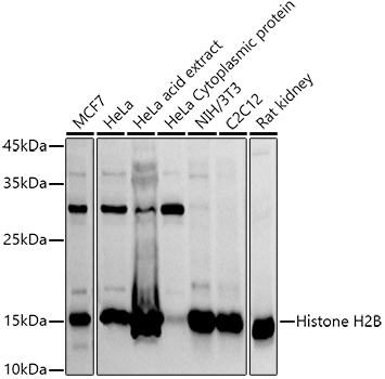 Histone H2B Rabbit Polyclonal Antibody