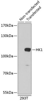 HK1 Rabbit Polyclonal Antibody