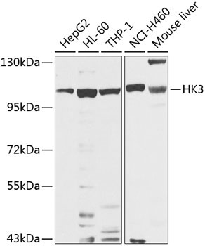 HK3 Rabbit Polyclonal Antibody