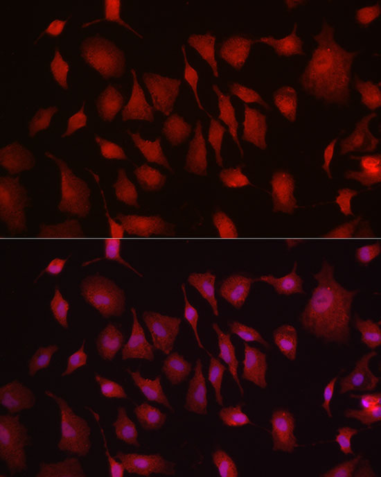 HK3 Rabbit Polyclonal Antibody - Image 2
