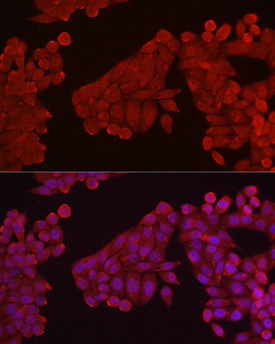 HK3 Rabbit Polyclonal Antibody - Image 3