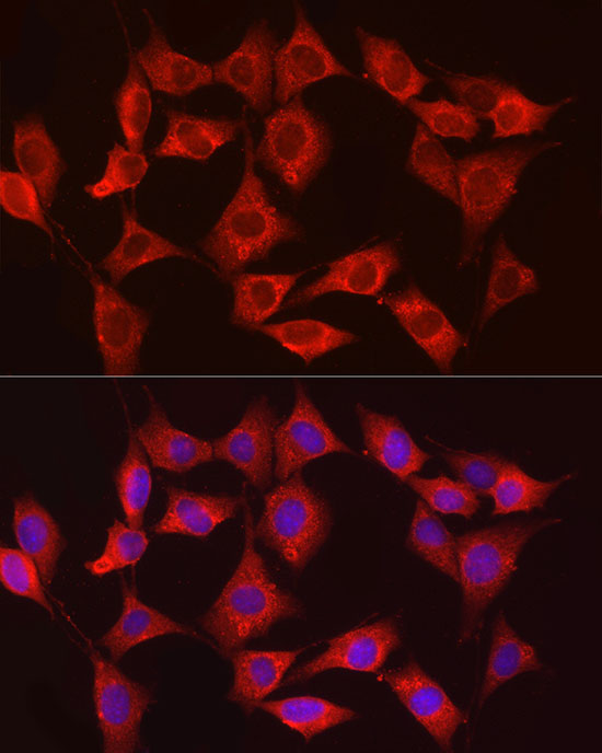 HK3 Rabbit Polyclonal Antibody - Image 4