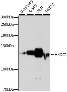 HKDC1 Rabbit Polyclonal Antibody