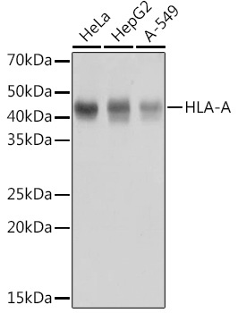 HLA-A Rabbit Monoclonal Antibody