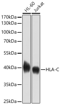 HLA-A+HLA-B+HLA-C Rabbit Polyclonal Antibody