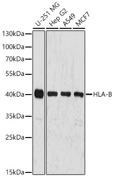 HLA-A+HLA-B+HLA-C Rabbit Polyclonal Antibody
