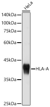 HLA-A+HLA-B+HLA-C Rabbit Polyclonal Antibody