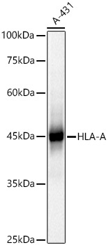 HLA-A+HLA-B+HLA-C Rabbit Polyclonal Antibody