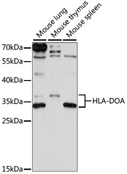 HLA-DOA Rabbit Polyclonal Antibody