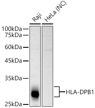 HLA-DPB1 Rabbit Polyclonal Antibody
