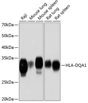 HLA-DQA1 Rabbit Monoclonal Antibody