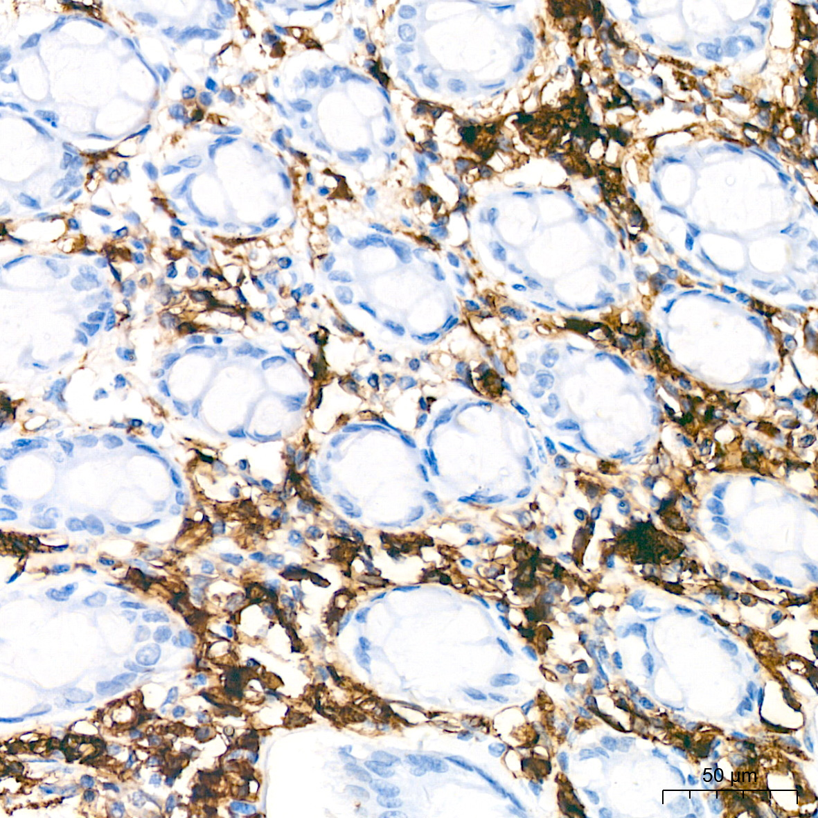 HLA-DQA1 Rabbit Monoclonal Antibody - Image 2