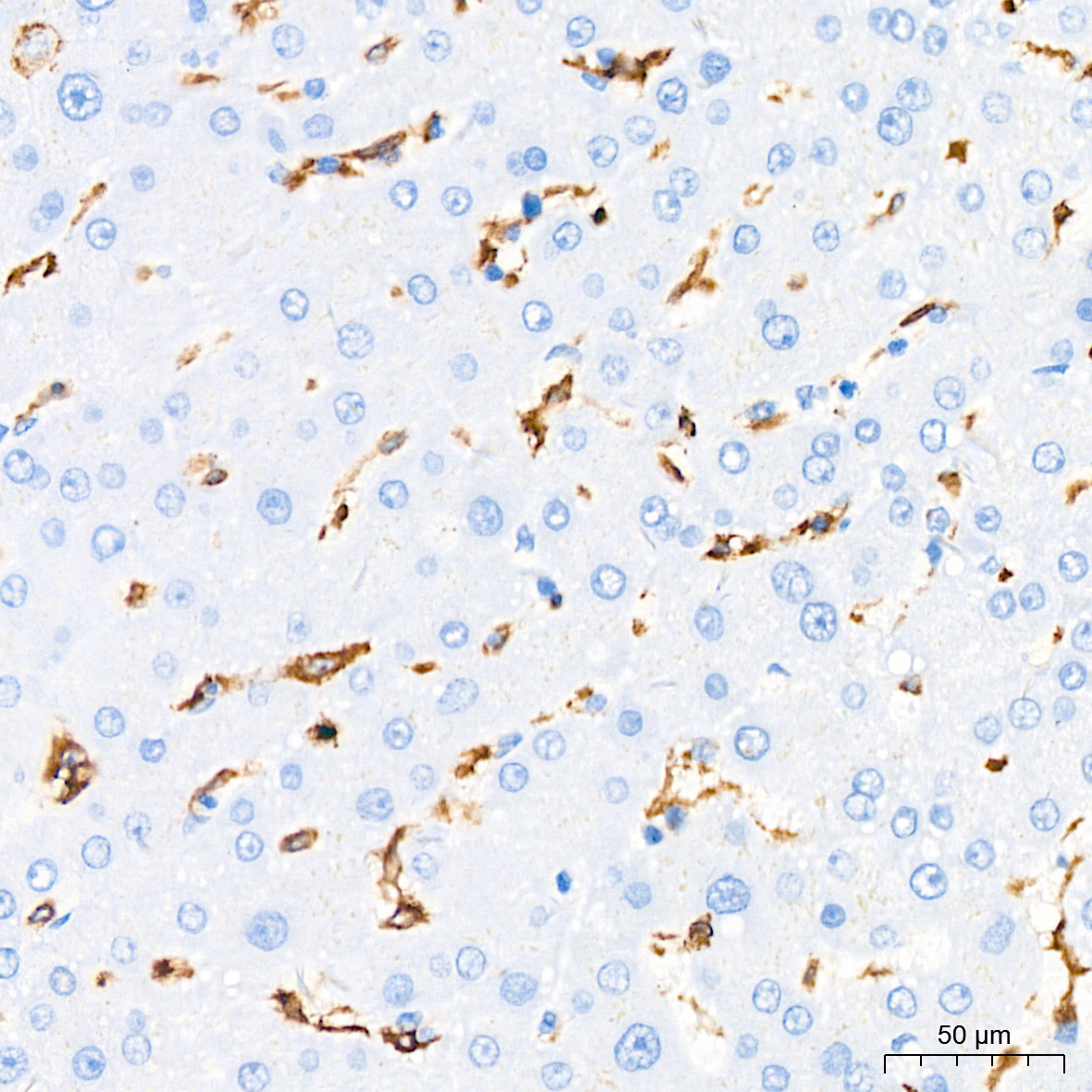 HLA-DQA1 Rabbit Monoclonal Antibody - Image 3