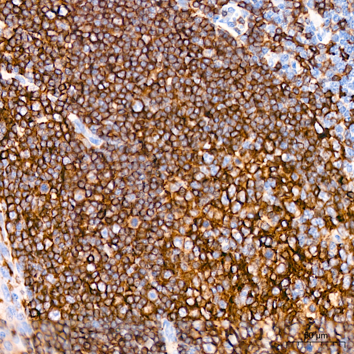 HLA-DQA1 Rabbit Monoclonal Antibody - Image 4