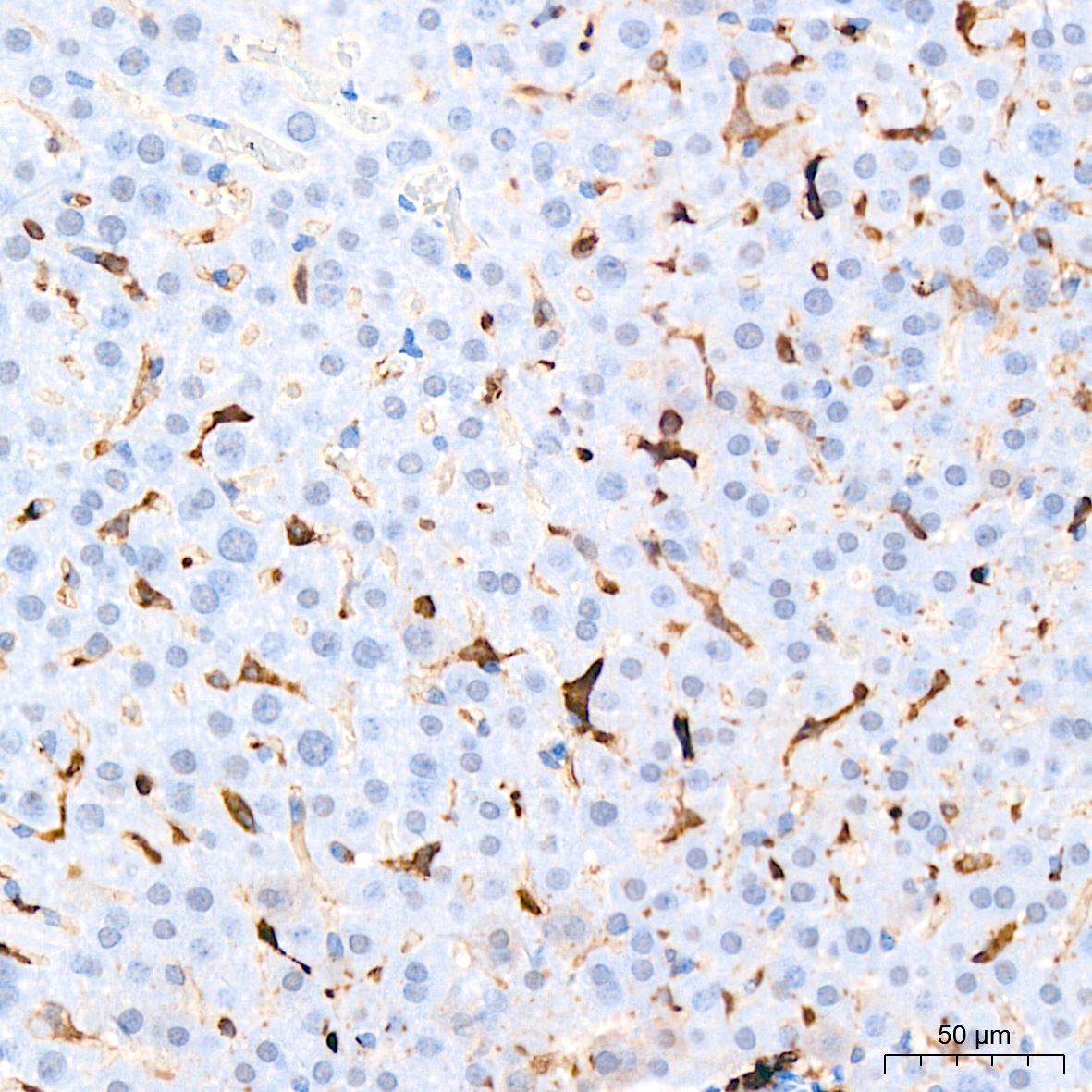 HLA-DQA1 Rabbit Monoclonal Antibody - Image 5