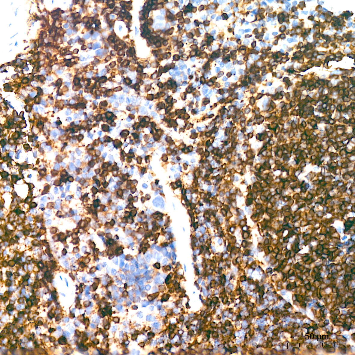 HLA-DQA1 Rabbit Monoclonal Antibody - Image 6