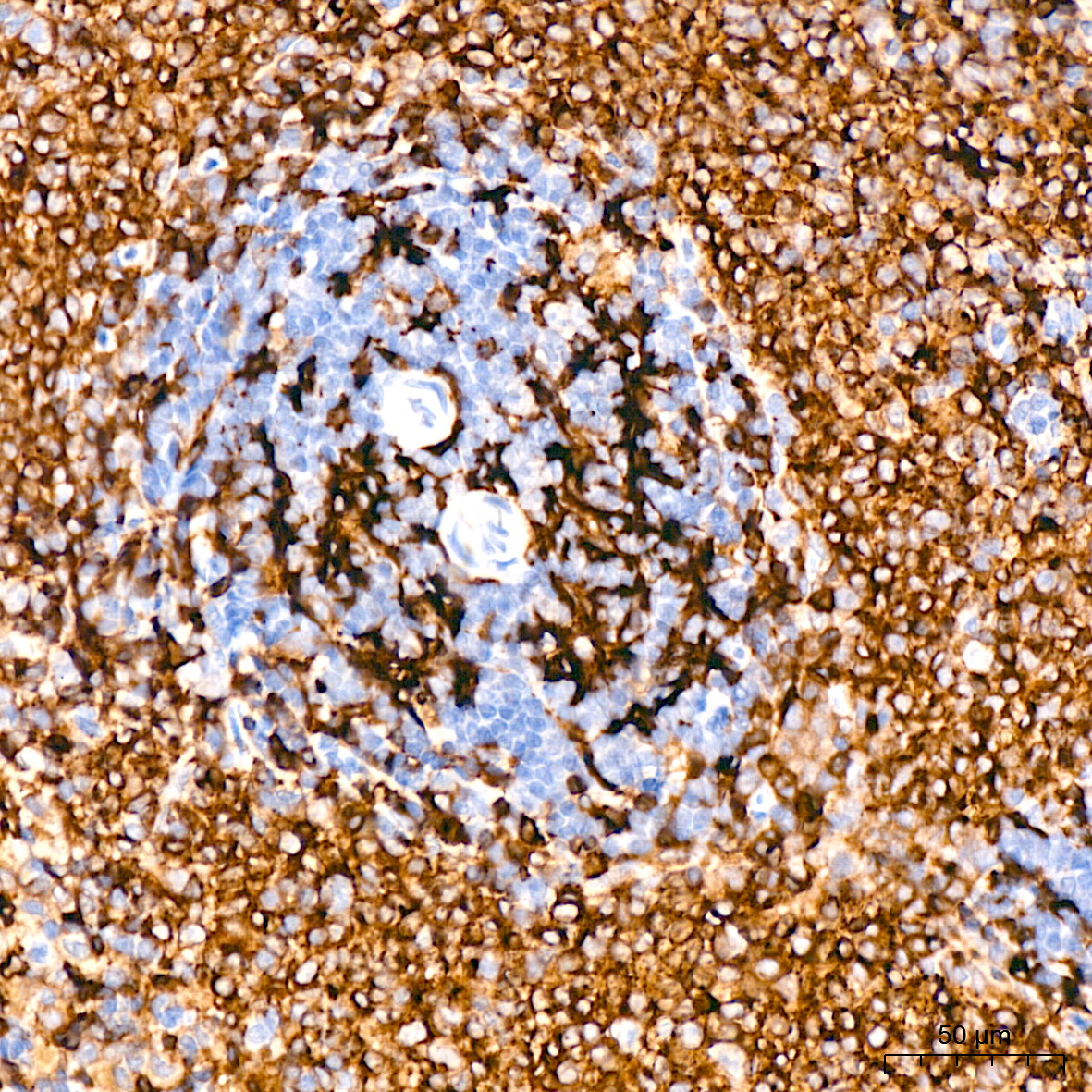 HLA-DQA1 Rabbit Monoclonal Antibody - Image 7