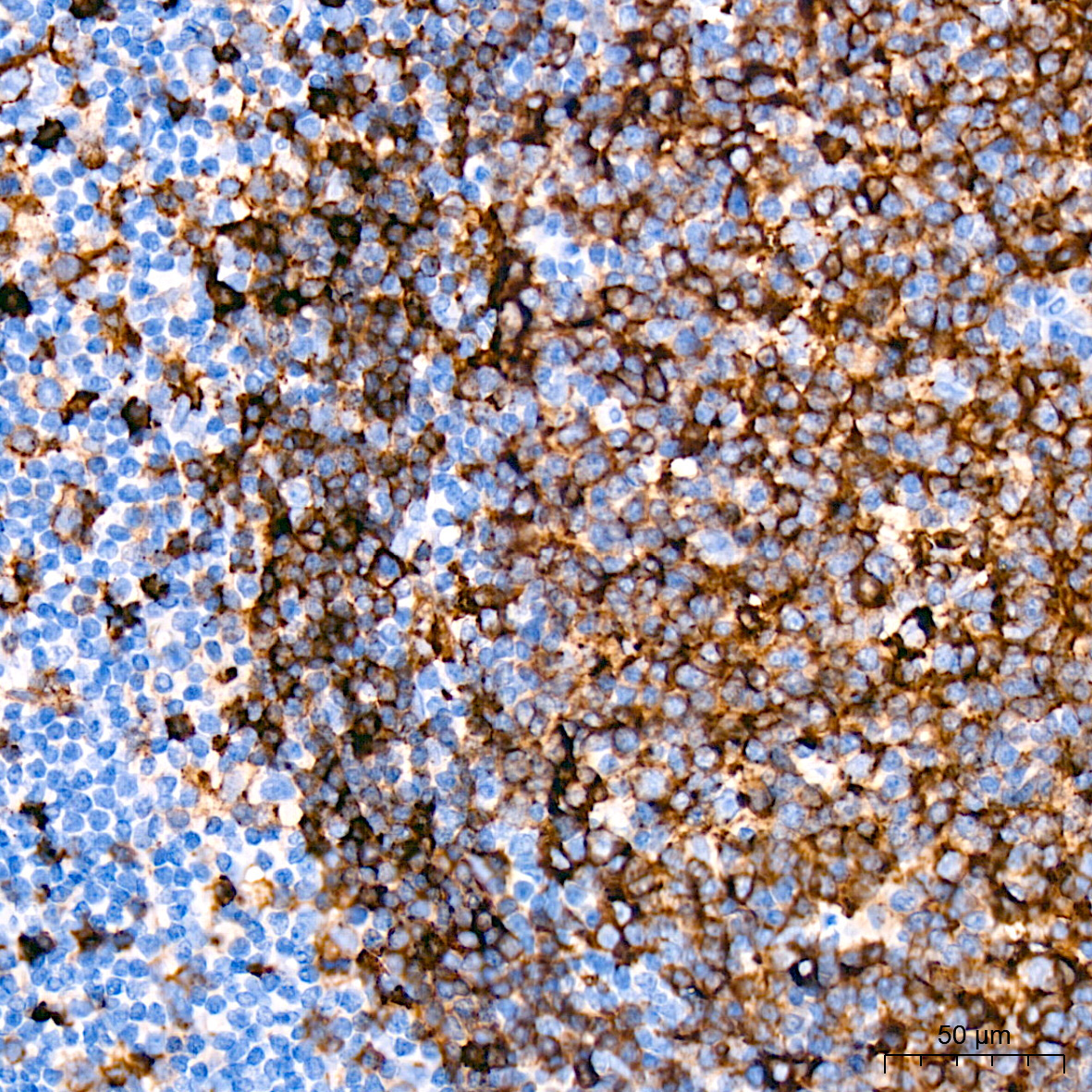 HLA-DRA Rabbit Monoclonal Antibody - Image 2