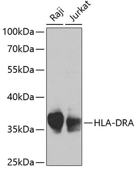 HLA-DRA Rabbit Polyclonal Antibody