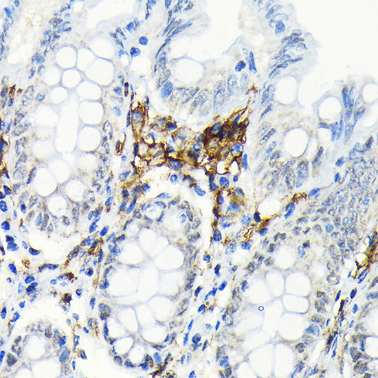 HLA-DRB1 Rabbit Monoclonal Antibody - Image 2