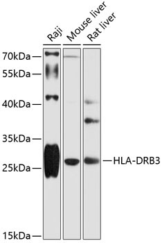 HLA-DRB3 Rabbit Polyclonal Antibody