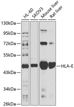 HLA-E Rabbit Polyclonal Antibody