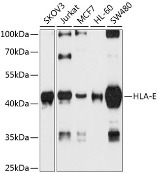 HLA-E Rabbit Polyclonal Antibody