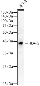 HLA-G Rabbit Polyclonal Antibody
