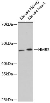HMBS Rabbit Monoclonal Antibody
