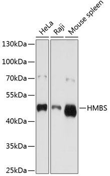 HMBS Rabbit Polyclonal Antibody