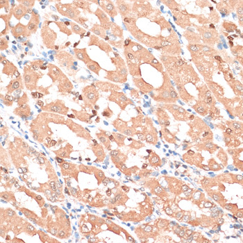 HMGA1 Rabbit Polyclonal Antibody - Image 2