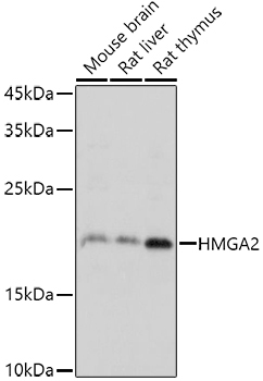 HMGA2 Rabbit Polyclonal Antibody - Image 2