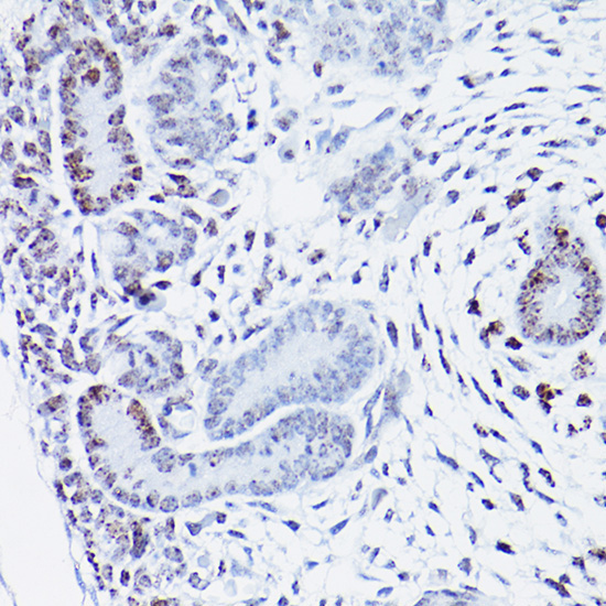 HMGA2 Rabbit Polyclonal Antibody - Image 3