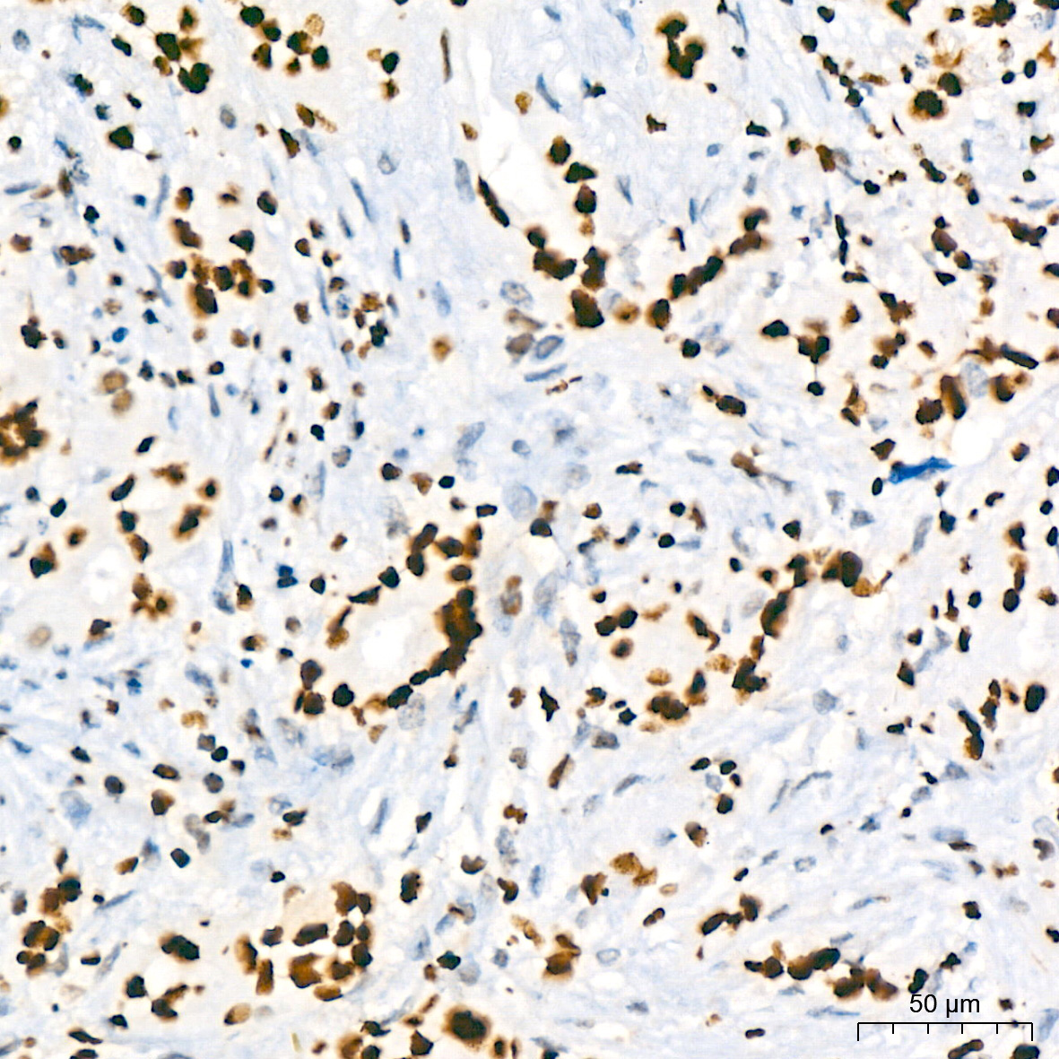 HMGB2 Rabbit Monoclonal Antibody - Image 2