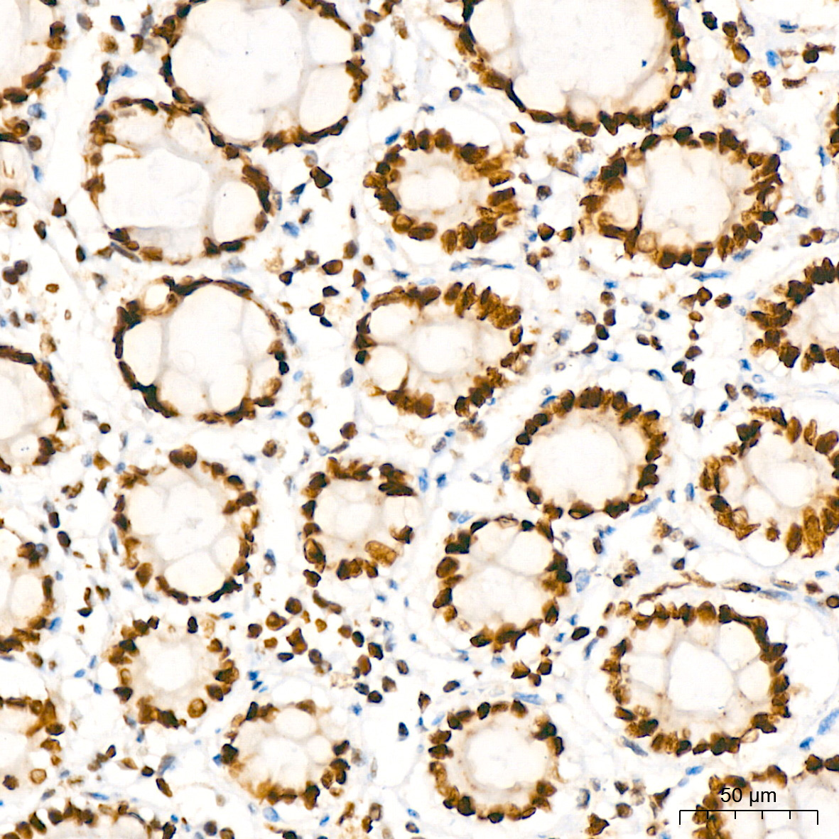 HMGB2 Rabbit Monoclonal Antibody - Image 3