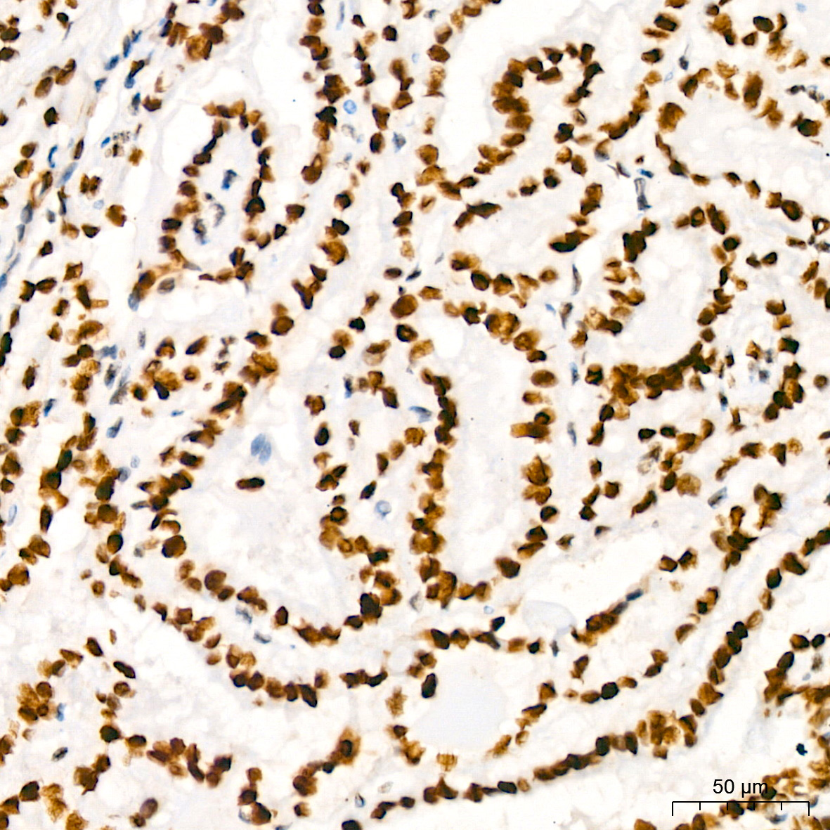 HMGB2 Rabbit Monoclonal Antibody - Image 4