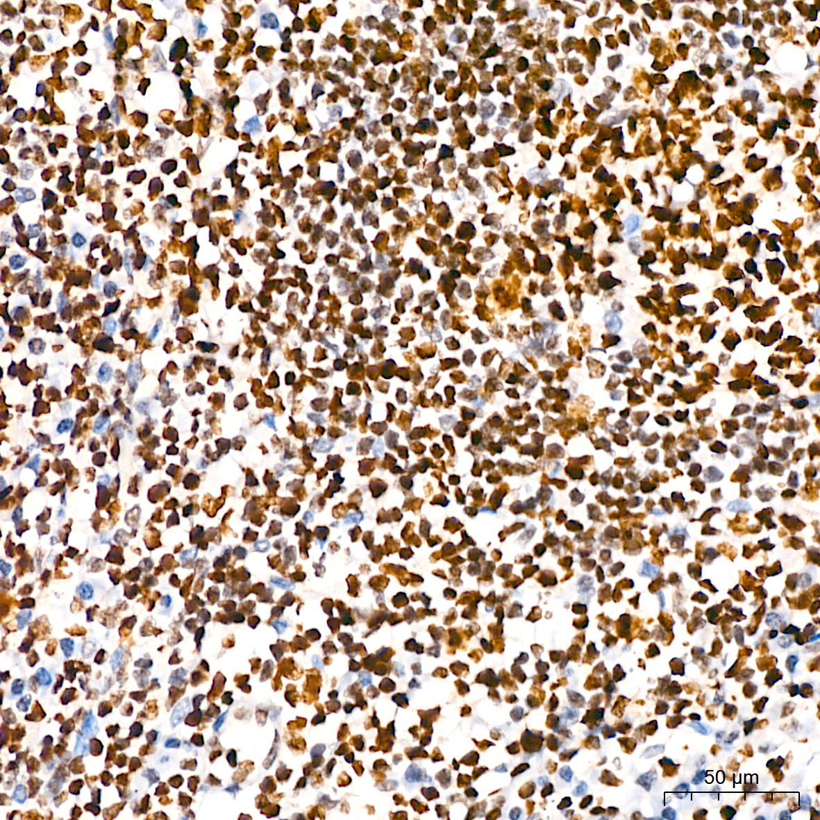 HMGB2 Rabbit Monoclonal Antibody - Image 5