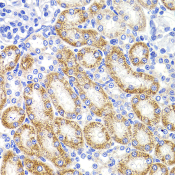 HMGCL Rabbit Polyclonal Antibody - Image 2