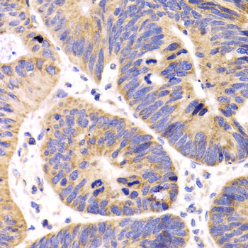 HMGCL Rabbit Polyclonal Antibody - Image 3
