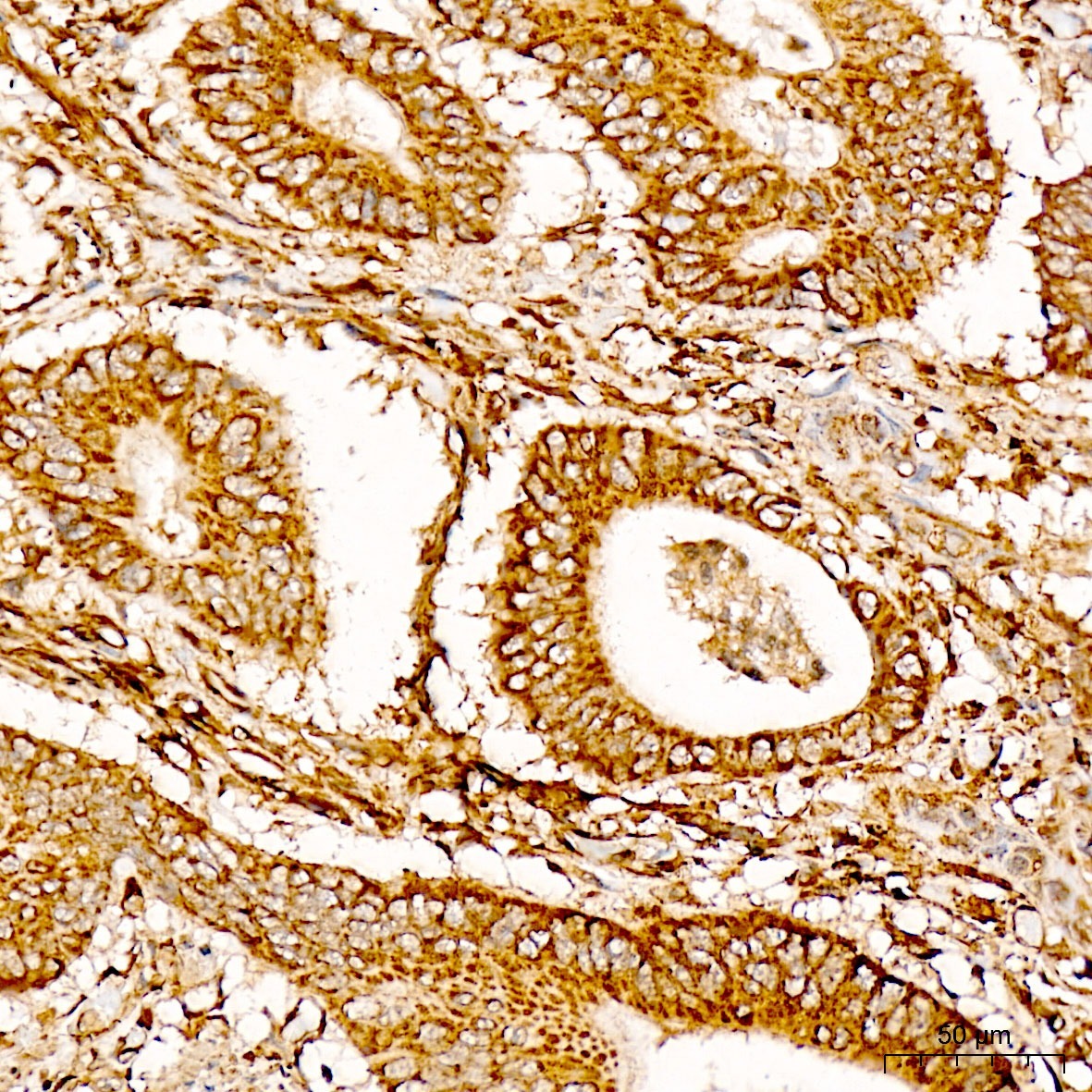 HMGCR Rabbit Polyclonal Antibody - Image 2