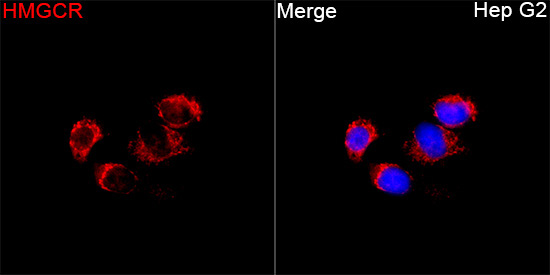 HMGCR Rabbit Polyclonal Antibody - Image 3