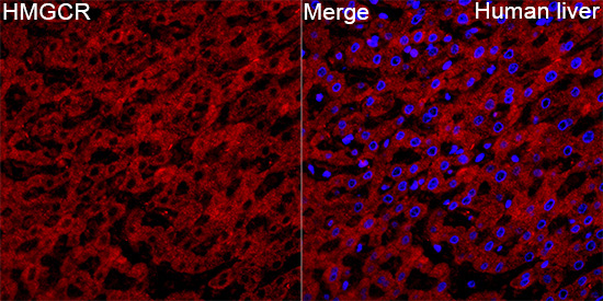 HMGCR Rabbit Polyclonal Antibody - Image 4