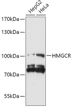 HMGCR Rabbit Polyclonal Antibody