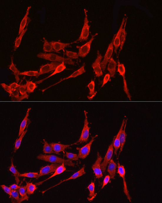 HMGCR Rabbit Polyclonal Antibody - Image 10