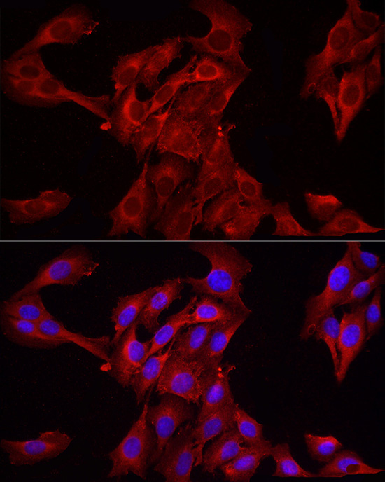 HMGCR Rabbit Polyclonal Antibody - Image 11