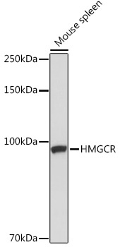 HMGCR Rabbit Polyclonal Antibody - Image 2