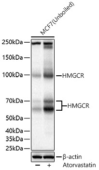 HMGCR Rabbit Polyclonal Antibody - Image 3
