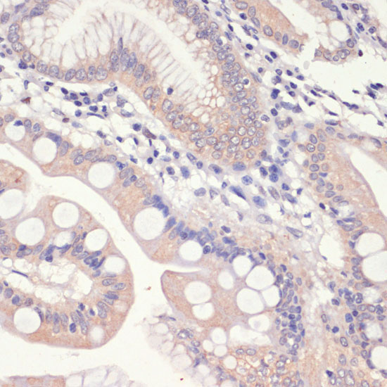 HMGCR Rabbit Polyclonal Antibody - Image 4