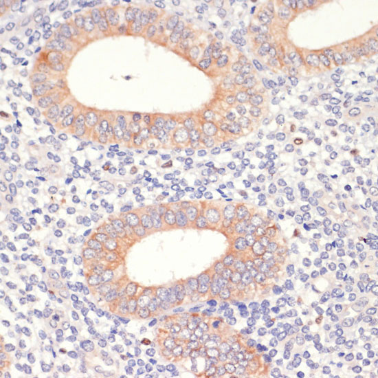 HMGCR Rabbit Polyclonal Antibody - Image 5