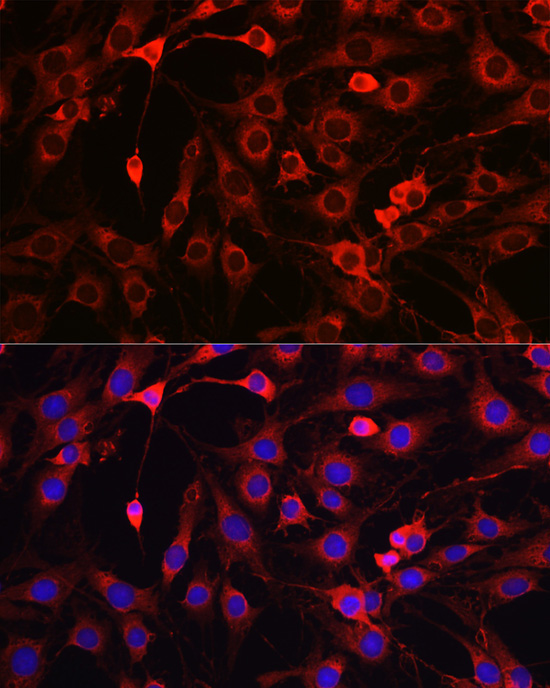 HMGCR Rabbit Polyclonal Antibody - Image 6